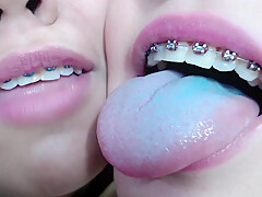 Young brace lesbians tounge kissing